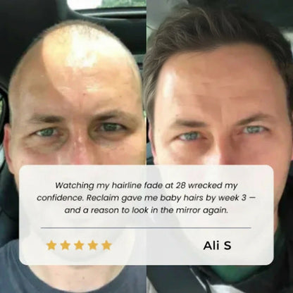 Advanced Hair Growth Roll-On Serum